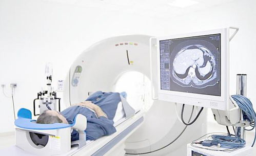 第一類醫(yī)療器械經(jīng)營(yíng) 無需備案，但需合規(guī)